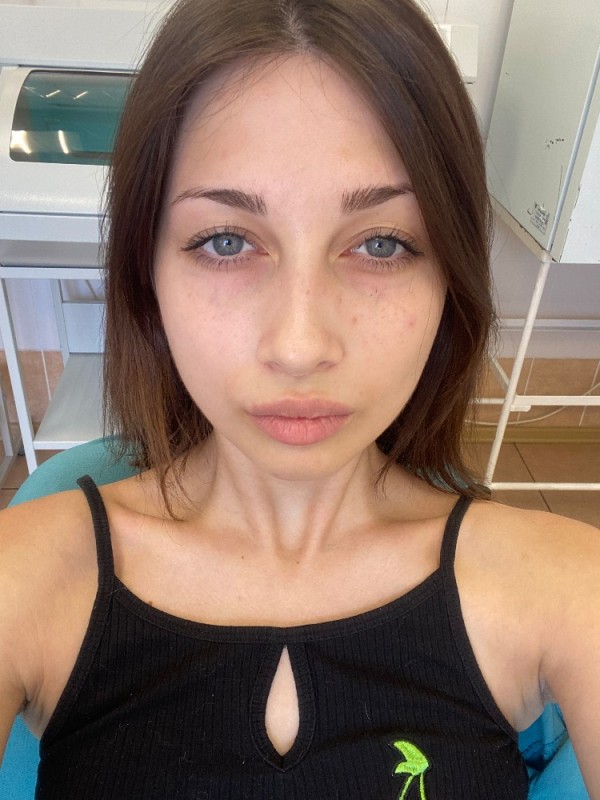 Create meme: girl , Nastya Kiushkina 2022, transconjunctive blepharoplasty of the lower eyelids