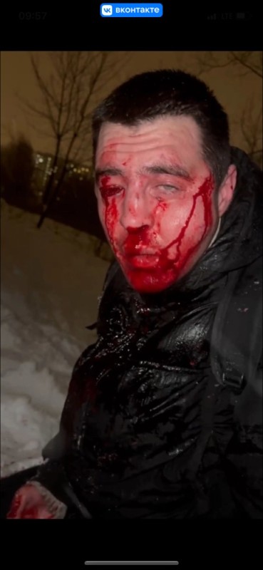 Create meme: broken face , after the attack, Russia