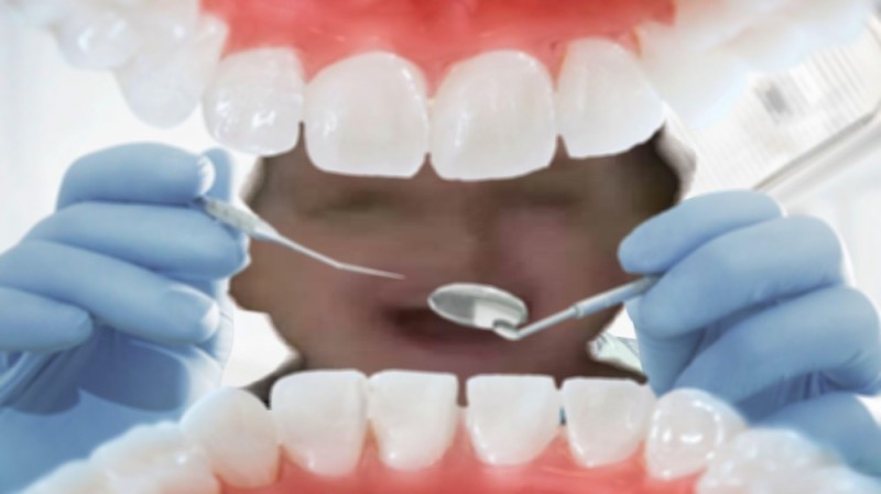 Создать мем: комплексная чистка зубов, зубы, открытый рот у зубного