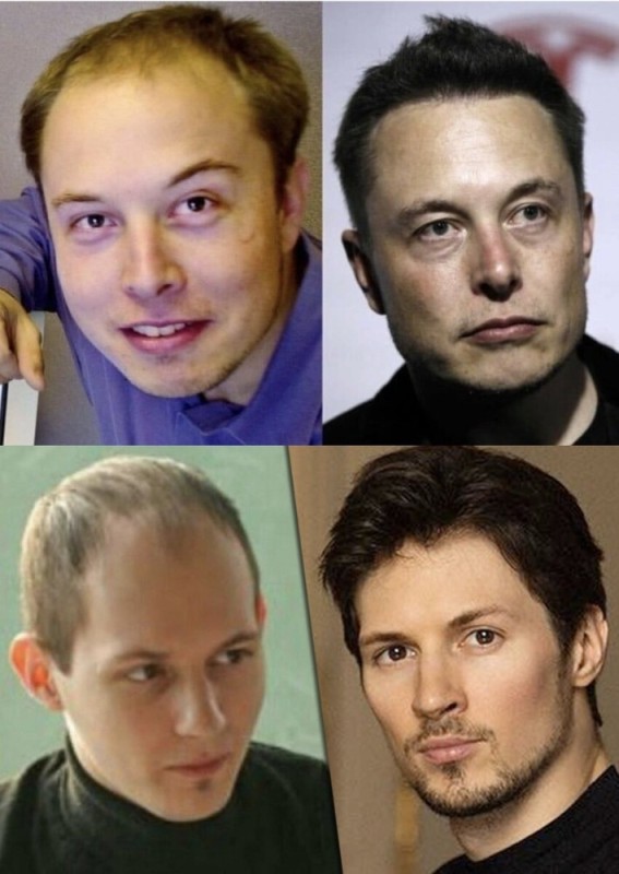 Create meme: Pavel Durov before hair transplantation and plastic surgery, Pavel Durov before the hair transplant, Durov before the hair transplant