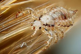 Create meme: head lice, lice, without transformation , they develop