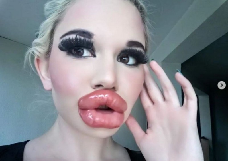 Create meme: the girl with big lips, huge silicone lips, the girl with the biggest lips