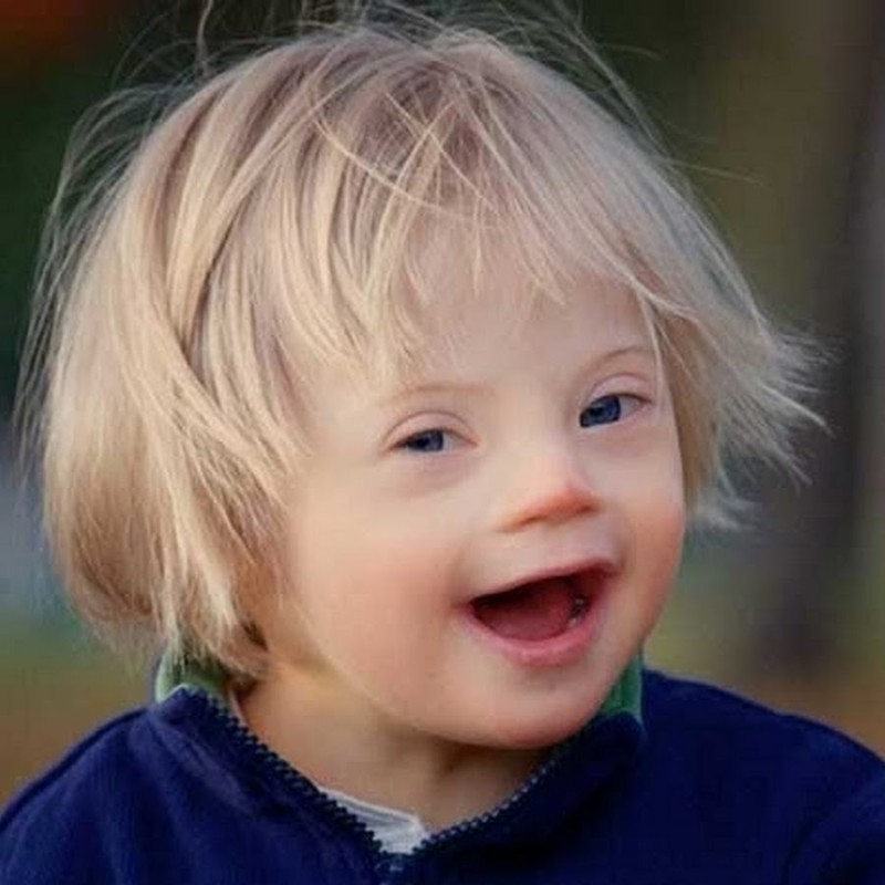 Create meme: down syndrome , down syndrome signs, psychological characteristics of children with down syndrome