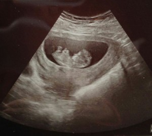 Create meme: pregnancy ultrasound