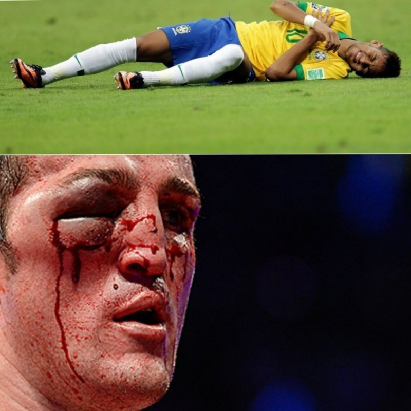 Create meme: Jones Guillermo, Denis Lebedev, Guillermo Jones, Denis Lebedev hematoma