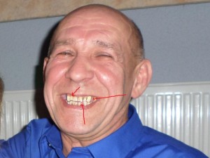 Create meme: teeth, Valery Ivanovich, Part of the face