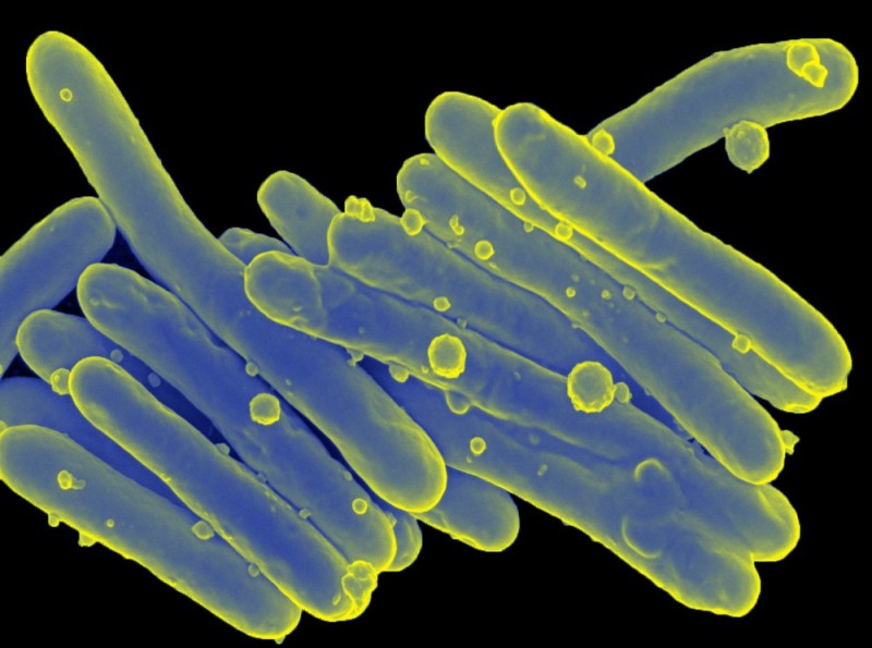 Создать мем: микобактерии, палочка коха mycobacterium tuberculosis, бактерии палочки