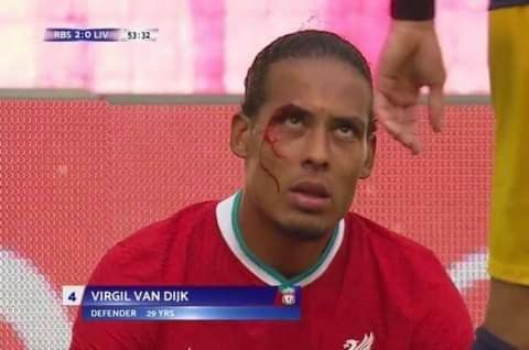 Create meme: virgil van dijk, Virgil van dijk injury, Virgil van Dijk player