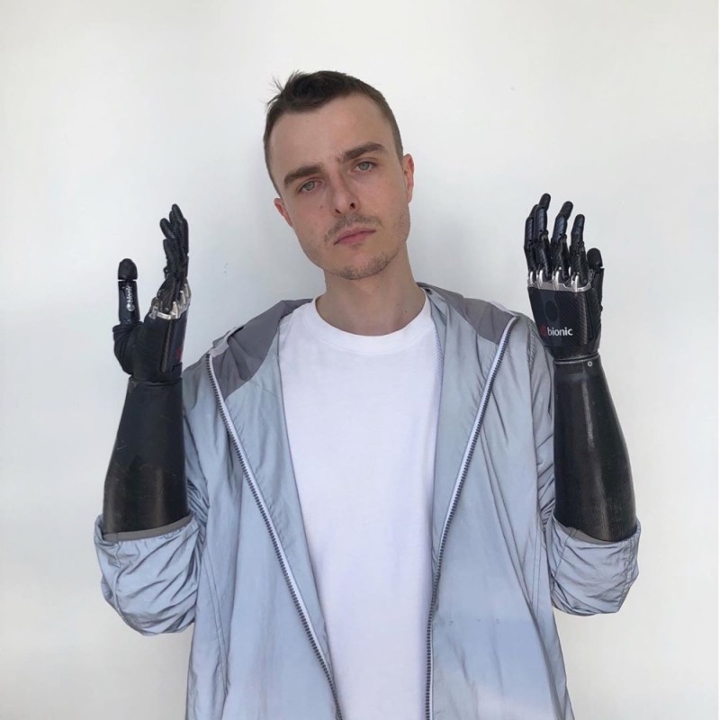 Create meme: prosthetic arm, bionic Konstantin Deblikov, deblikov konstantin cyborg