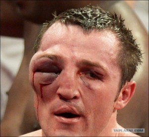 Create meme: Denis Lebedev photo after the fight, Denis Lebedev, Guillermo Jones, Denis Lebedev bruise