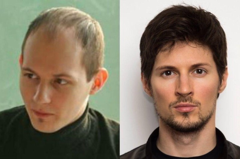 Create meme: Pavel Durov hair, Durov before plastic surgery, Pavel Durov to plastics