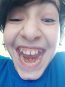 Create meme: bite, teeth in children, milk teeth