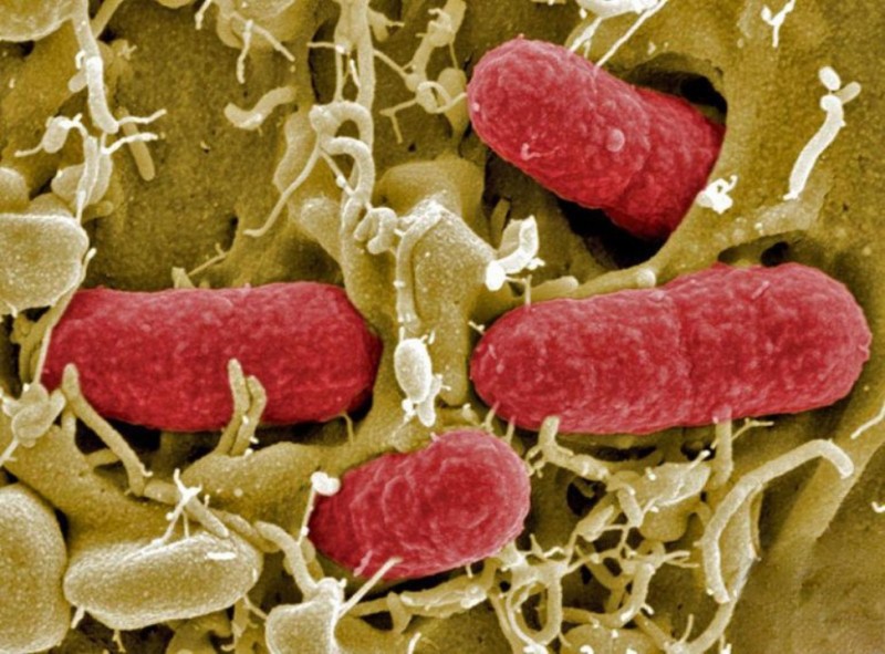 Создать мем: escherichia coli в микроскопе, эшерихии резистентность, бактерии