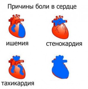 Create meme: Causes of pain in the heart