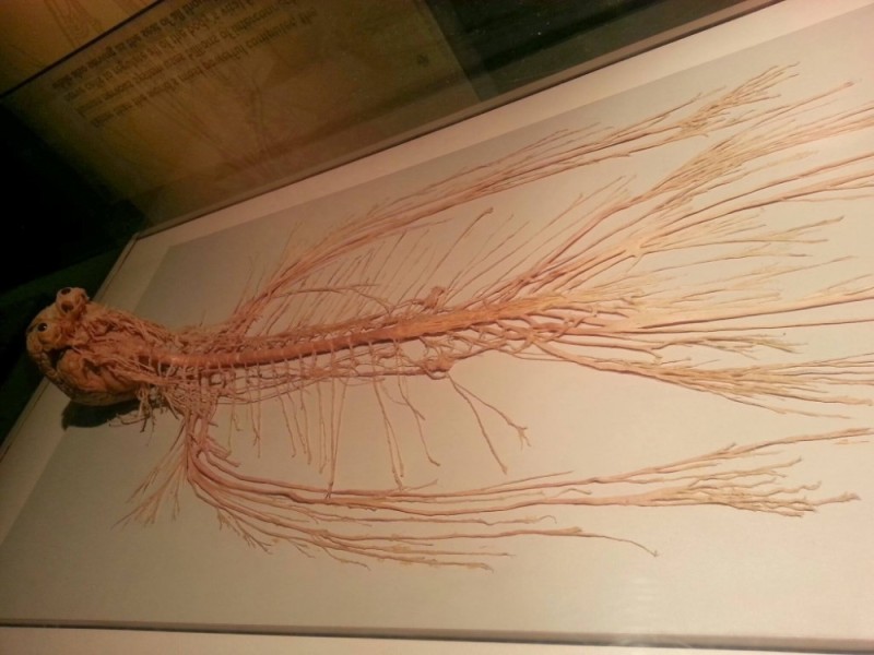 Create meme: the human nervous system, Harriet Cole, dissected human nervous system