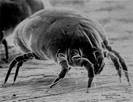 Create meme: dermatophagoides pteronyssinus, mite, a flea under a microscope photos