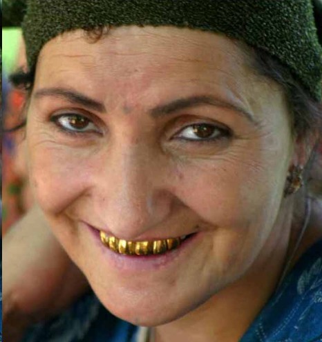 Мигранта с золотыми зубами подозревают в изнасиловании девушки в Славянке