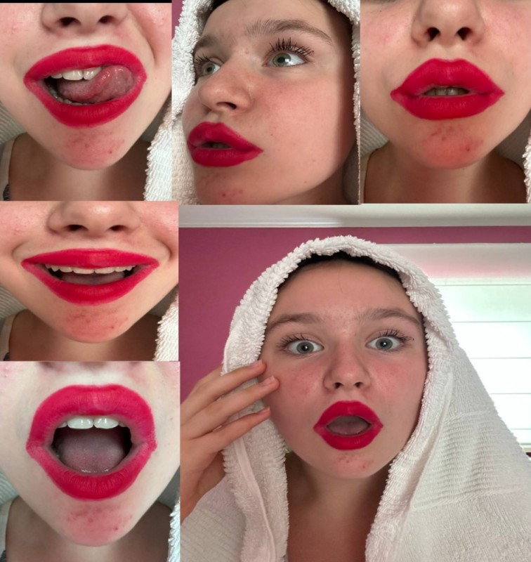 Create meme: lips are big, lip augmentation, lips are plump