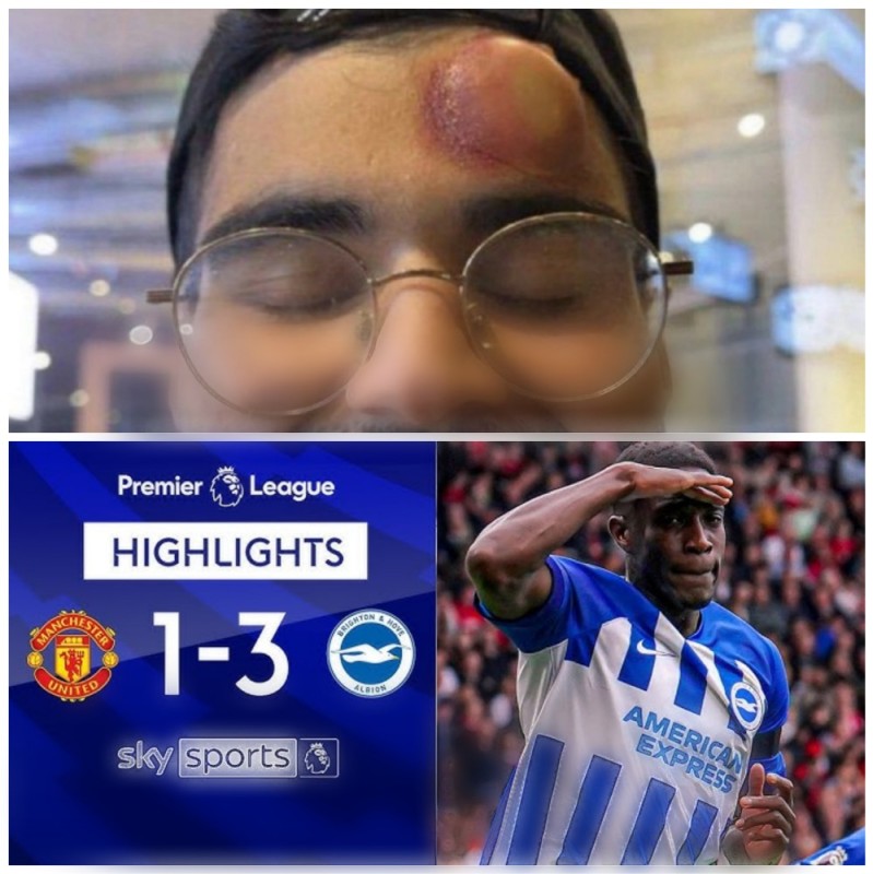 Create meme: premier league , champions league , traces on the skin