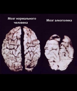 Создать мем: мозг токсикомана фото, мозг пьющего человека, мозг алкоголика