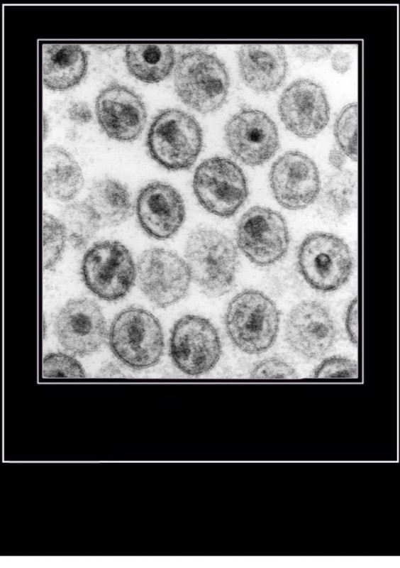 Create meme: micrography of the HIV virus, the hiv virus under the microscope, Epstein-barr virus under the microscope