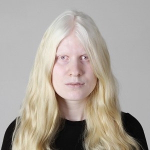 Create meme: girl, people with albinism, albino
