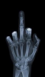 Create meme: fuck x-ray, pictures fuck, middle finger x-ray