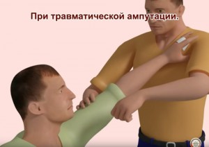 Create meme: exercises for the spine on norbekova, respiratory failure, first aid