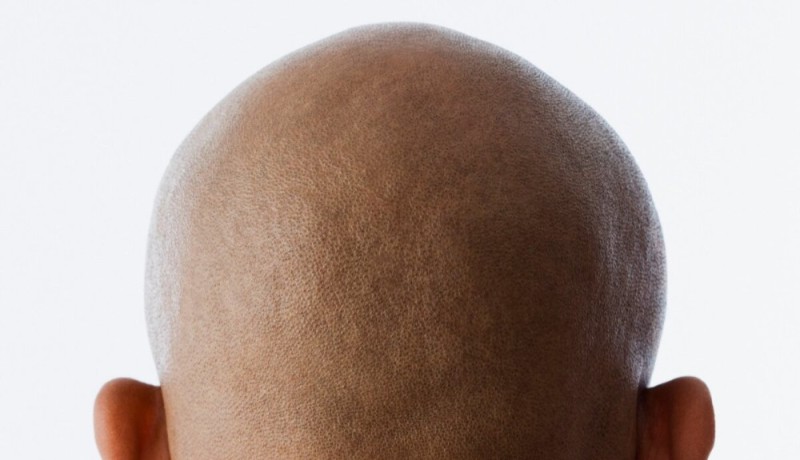 Create meme: bald head, bald nape, bald head from behind