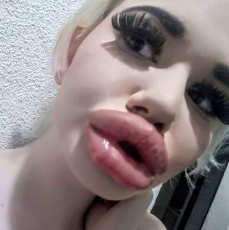 Создать мем: силиконовые губы, девушка с самыми большими губами, огромные силиконовые губы