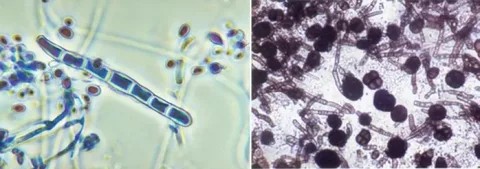 Создать мем: стригущий лишай под микроскопом, микроскопия trichophyton rubrum, лишай под микроскопом